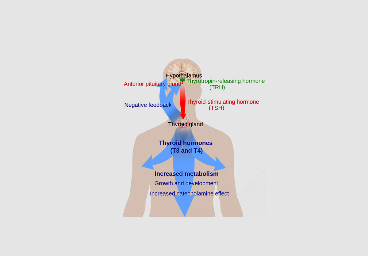 Hypothyroidism